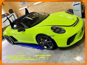 Porsche 991 Speedster